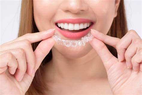 invisalign silkeborg|Invisalign .